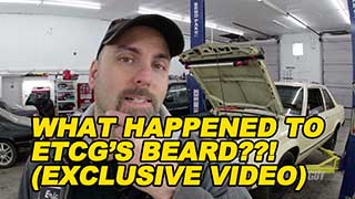 What Happened to ETCGs Beard
