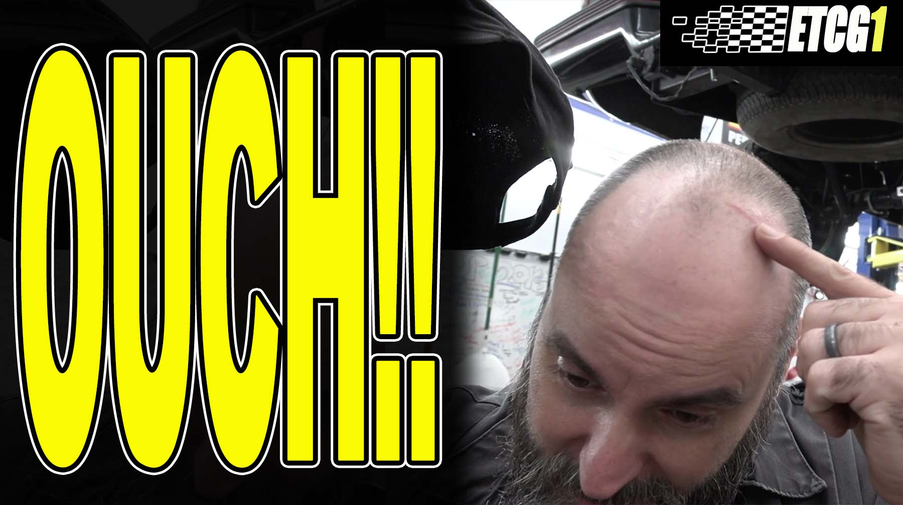 Hitting Your Head Hurts EricTheCarGuy